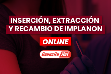 Inserción, Extracción y Recambio de Implanon Online 45 horas